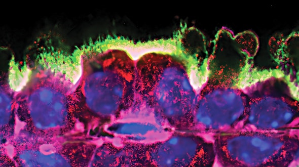 The choroid plexus undergoing apocrine secretion.