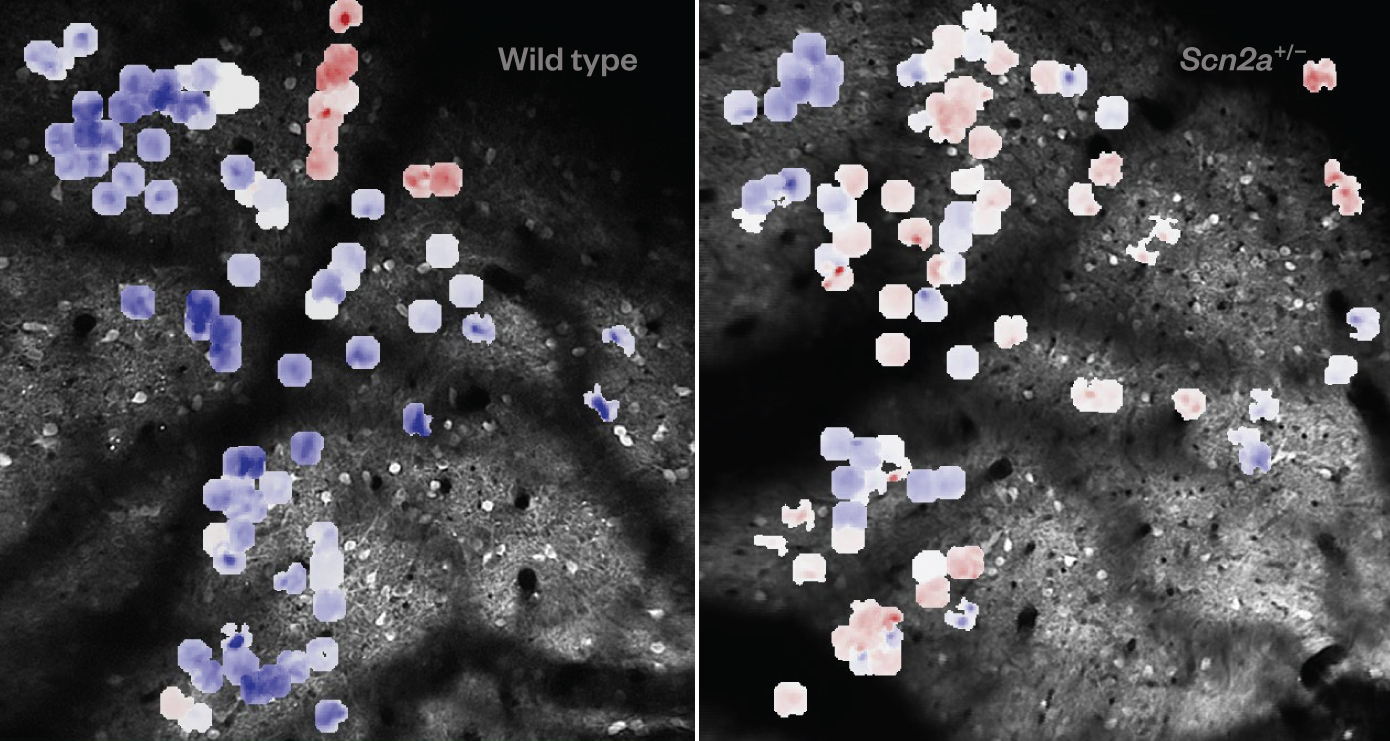 SFARI | Altered Corticotectal Circuitry Shapes Contextual Sensory ...