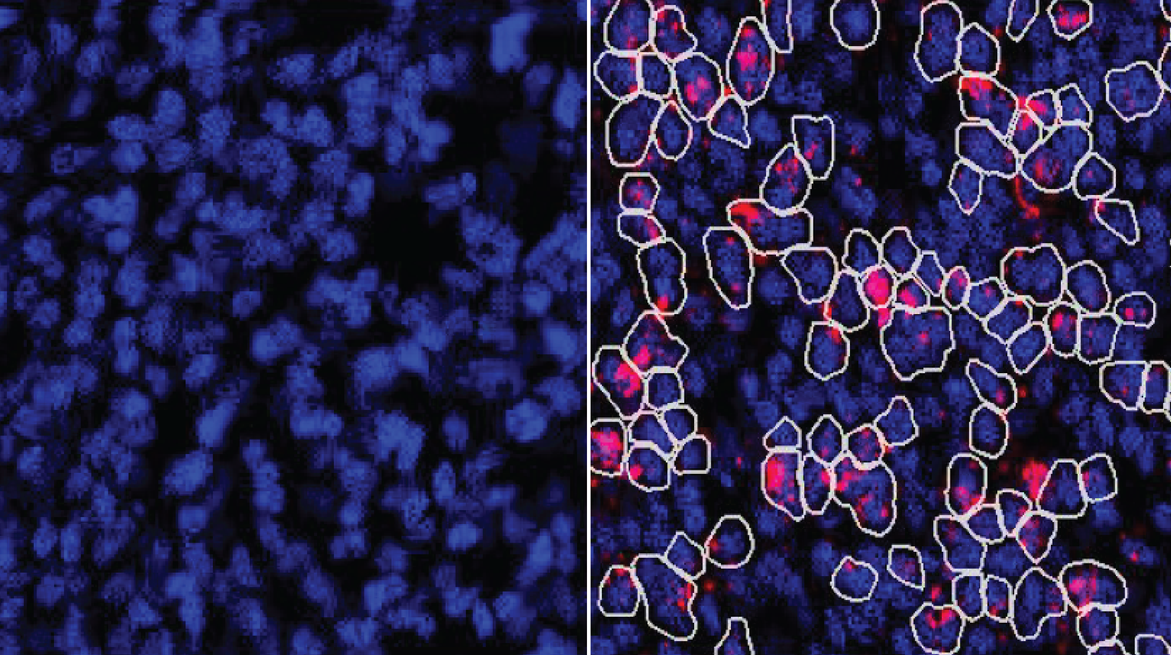 An image comparing the presence of ZBTB18 mRNA and ZBTB18 protein in germinal-zone cells shows that whilst RNA is detectable, the protein is not.