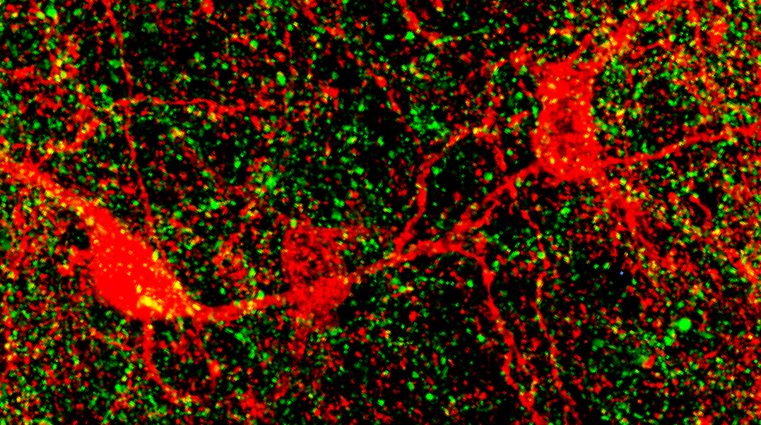 Confocal microscopy image of neurons in the nucleus accumbens of a mouse.
