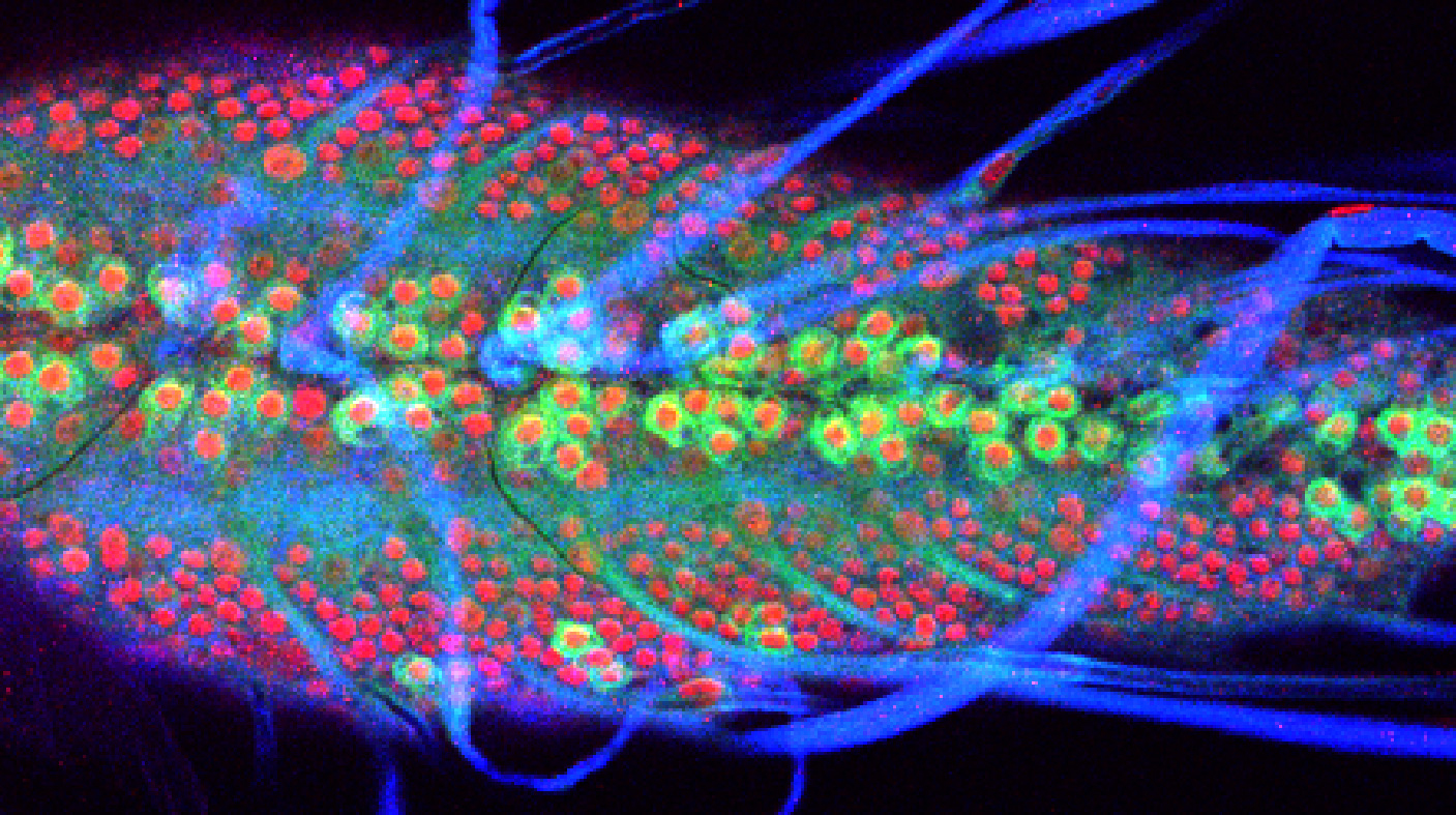 Confocal microscopy image showing neuronal expression of Chd1 in the Drosophila larval brain.