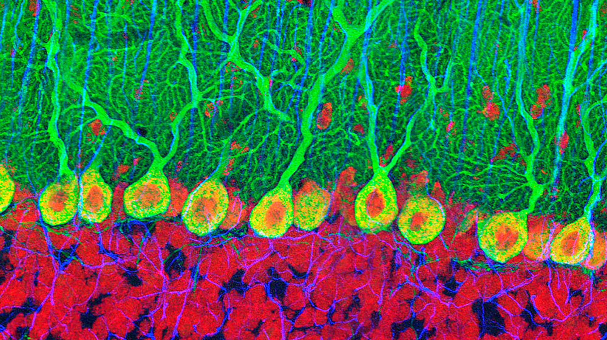 Purkinje nerve cells in the cerebellum.